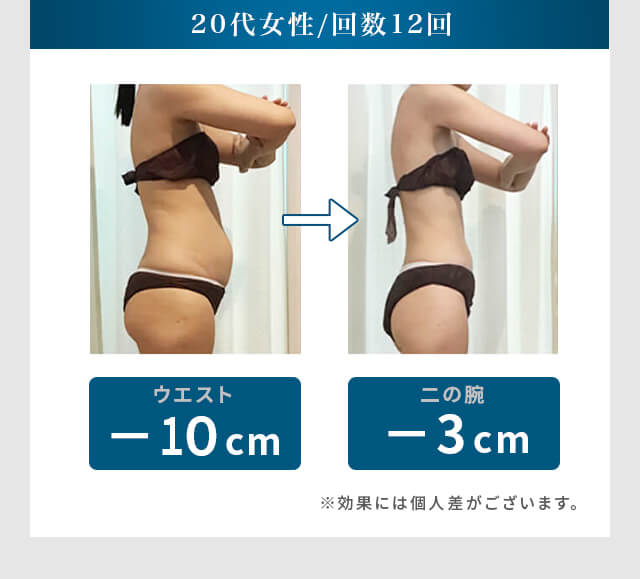 20代女性 / 回数12回 ウエスト -10cm 二の腕 -3cm