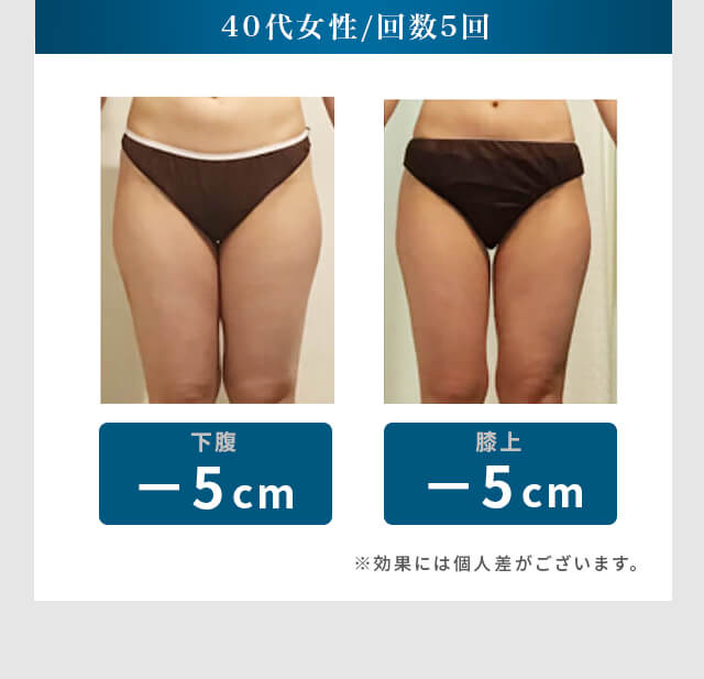 40代女性 / 回数5回 下腹 -5cm 膝上 -5cm